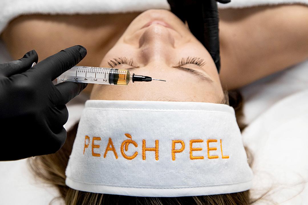 Биостимулирующий пилинг Peach Peel