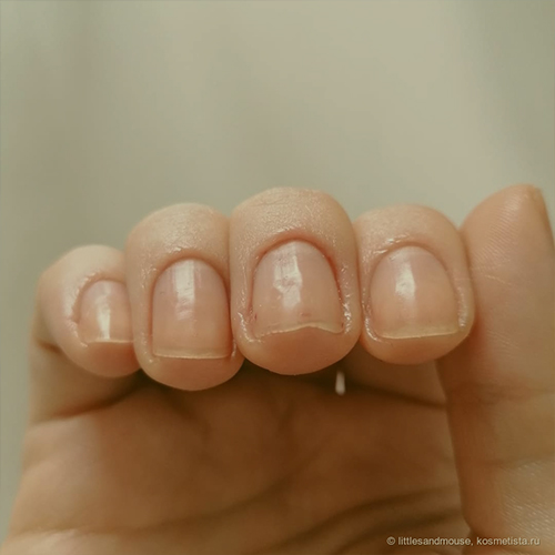 Damaged Nail Treatment