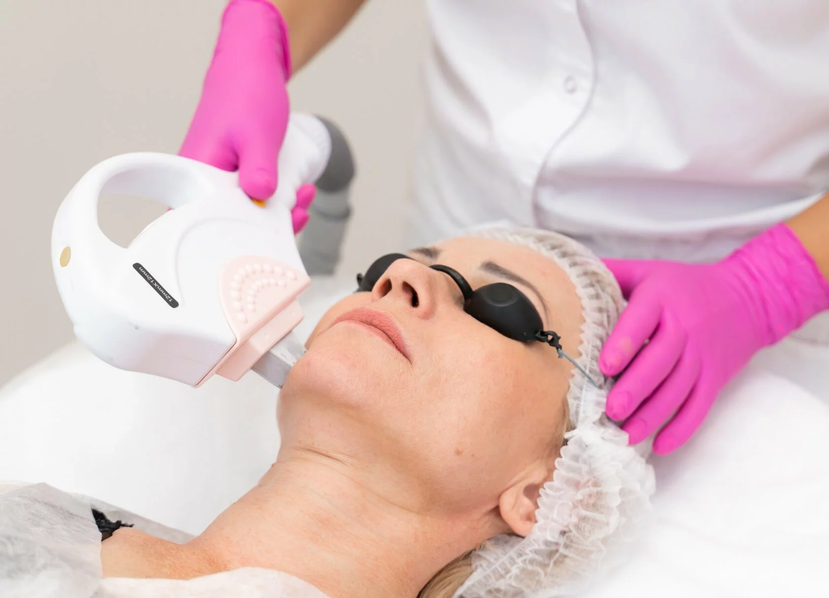 Phototherapy (IPL)